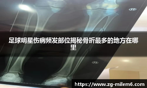 足球明星伤病频发部位揭秘骨折最多的地方在哪里